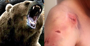 Bear Attack